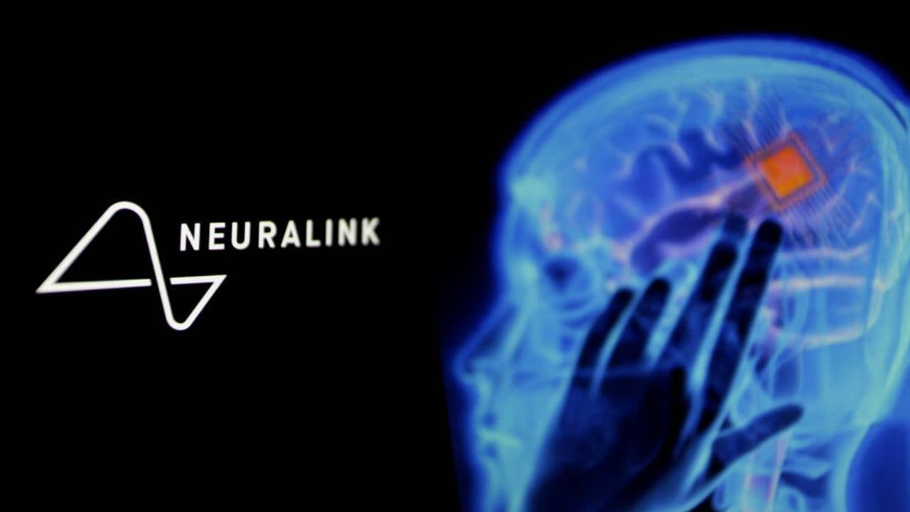 Neuralink et l'ère du BCI : Production de masse, Neurochip et Futur (2026)